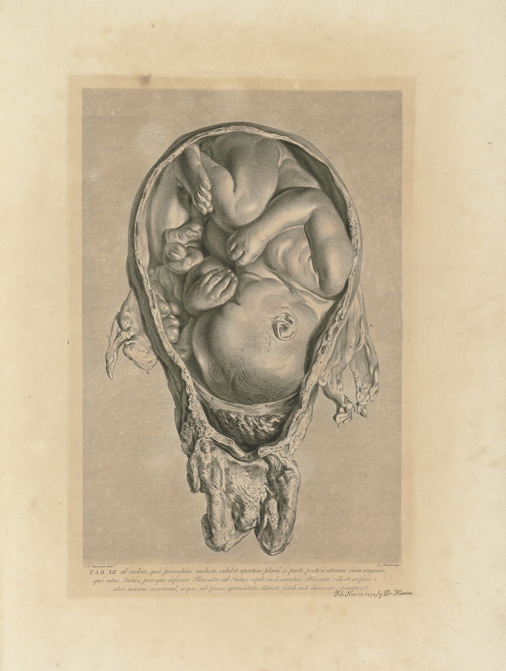 夏綠蒂的醫生威廉‧杭特（William Hunter）是第一個解剖孕婦子宮並研究其構造的學者。
