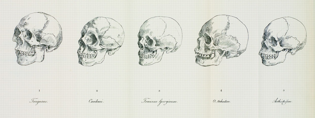 布魯門巴赫認定的五種人類頭顱。他認為一開始大家都是所謂的高加索人，但被逐出天堂之後有些人就墮落而變醜了。